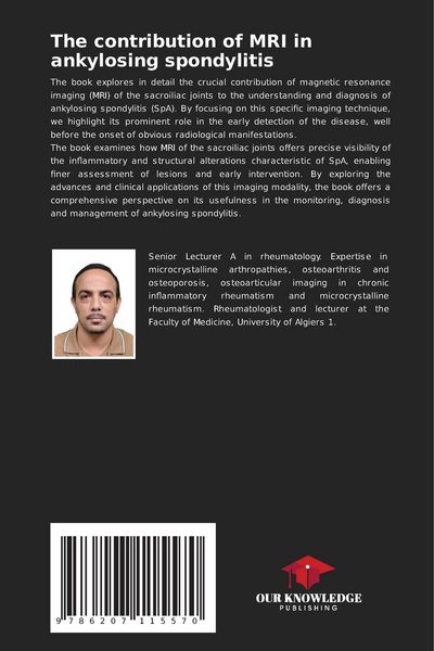 Produktbild: The contribution of MRI in ankylosing spondylitis