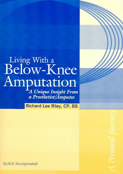 Produktbild: Living with a Below-Knee Amputation: A Unique Insight from a Prosthetist/Amputee