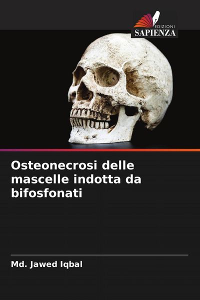 Produktbild: Osteonecrosi delle mascelle indotta da bifosfonati