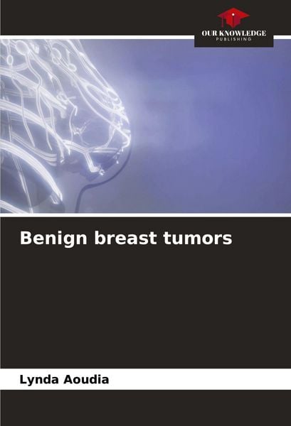 Produktbild: Benign breast tumors