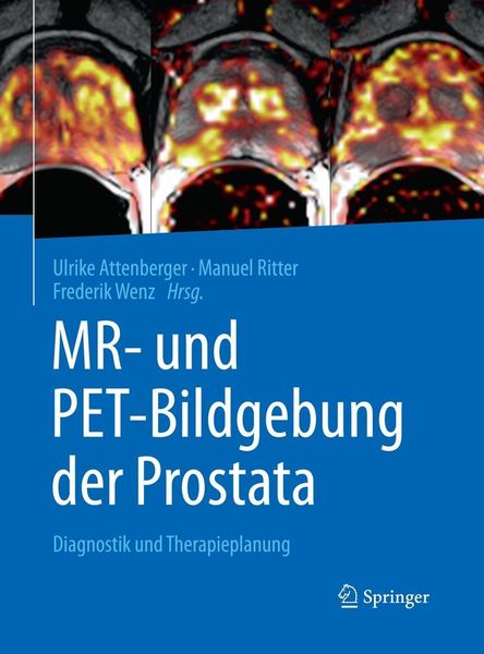 Produktbild: MR- und PET-Bildgebung der Prostata
