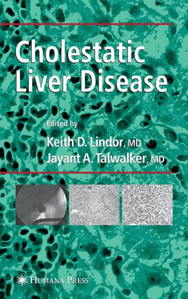 Produktbild: Cholestatic Liver Disease
