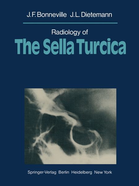 Produktbild: Radiology of The Sella Turcica