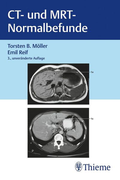 Produktbild: CT und MRT Normalbefunde