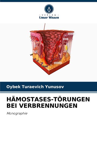 Hämostases-Törungen bei Verbrennungen, Taschenbuch von Oybek Turaevich Yunusov, Verlag Unser Wissen, 9786208791148