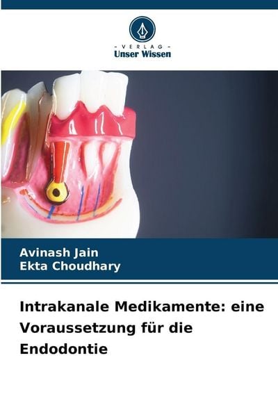Intrakanale Medikamente: eine Voraussetzung für die Endodontie, Taschenbuch von Avinash Jain , Ekta Choudhary, Verlag Unser Wissen, 9786206837398