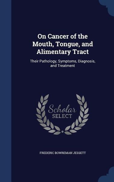Produktbild: On Cancer of the Mouth, Tongue, and Alimentary Tract