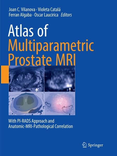Produktbild: Atlas of Multiparametric Prostate MRI