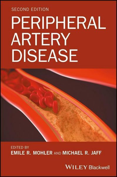 Produktbild: Peripheral Artery Disease