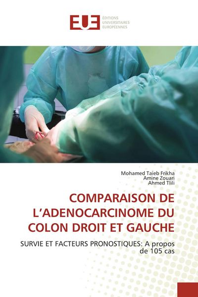 Produktbild: Comparaison De L'adenocarcinome Du Colon Droit Et Gauche