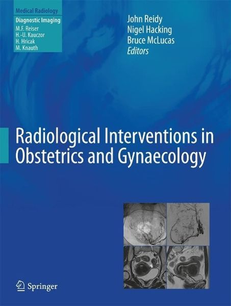 Produktbild: Radiological Interventions in Obstetrics and Gynaecology