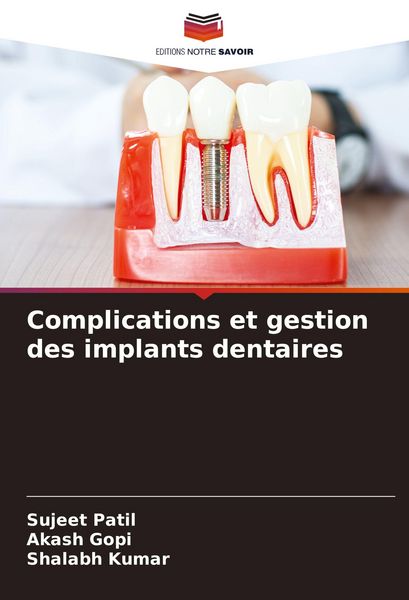 Produktbild: Complications et gestion des implants dentaires