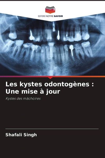 Produktbild: Les kystes odontog&egrave;nes : Une mise &agrave; jour