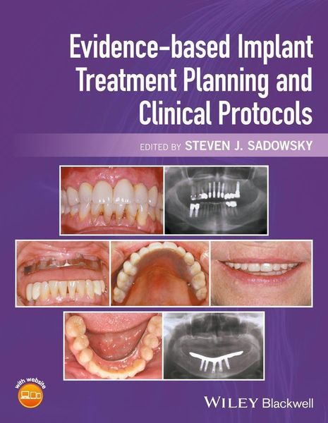 Produktbild: Evidence-based Implant Treatment Planning and Clinical Protocols