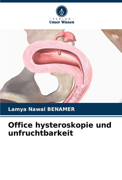 Office hysteroskopie und unfruchtbarkeit, Taschenbuch von Lamya Nawal BENAMER, Verlag Unser Wissen, 9786207560981