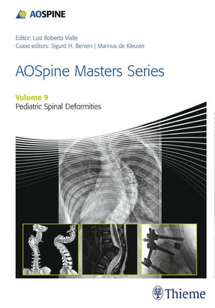 Produktbild: AOSpine Masters Series, Volume 9: Pediatric Spinal Deformities