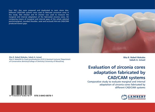 Produktbild: Evaluation of zirconia cores adaptation fabricated by CAD/CAM systems