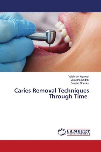 Produktbild: Caries Removal Techniques Through Time