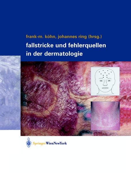 Produktbild: Fallstricke und Fehlerquellen in der Dermatologie
