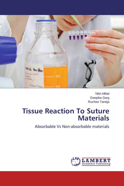 Produktbild: Tissue Reaction To Suture Materials
