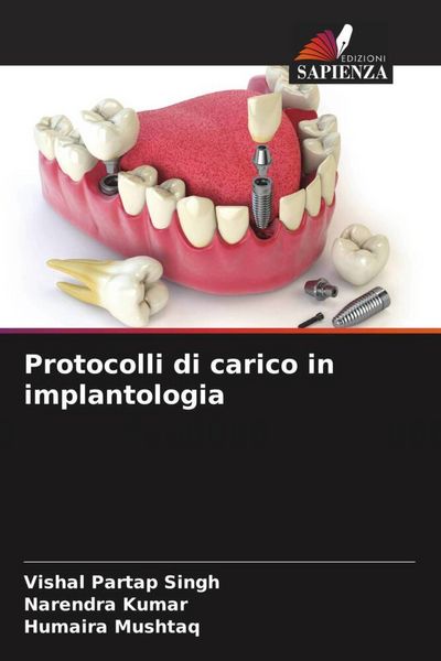 Produktbild: Protocolli di carico in implantologia