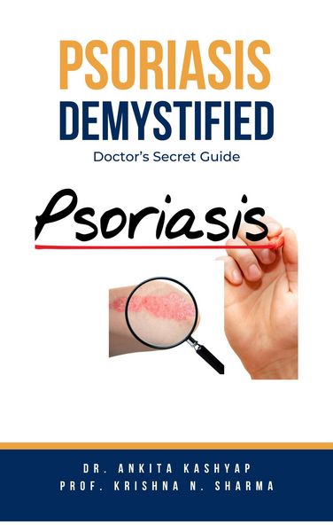 Produktbild: Psoriasis Demystified: Doctor's Secret Guide