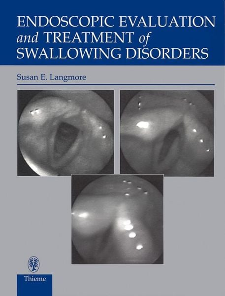 Produktbild: Endoscopic Evaluation and Treatment of Swallowing Disorders