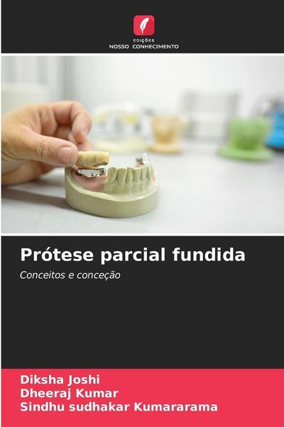 Produktbild: Pr&oacute;tese parcial fundida
