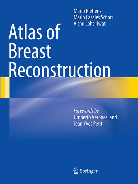 Produktbild: Atlas of Breast Reconstruction