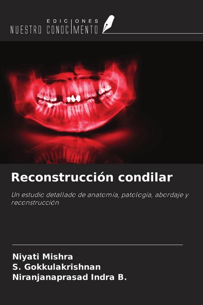 Produktbild: Reconstrucci&oacute;n condilar