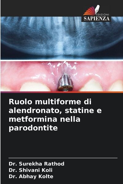 Produktbild: Ruolo multiforme di alendronato, statine e metformina nella parodontite