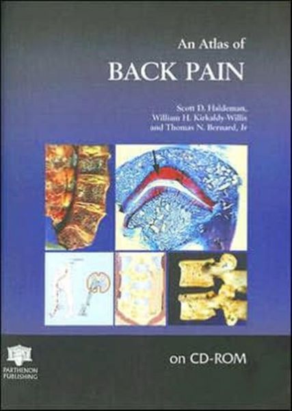 Produktbild: Atlas of Back Pain