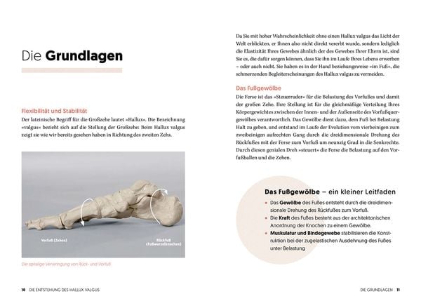 Produktbild: Hallux Valgus - Nachhaltige Hilfe ohne OP