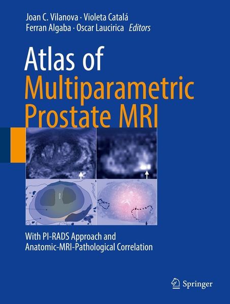 Produktbild: Atlas of Multiparametric Prostate MRI