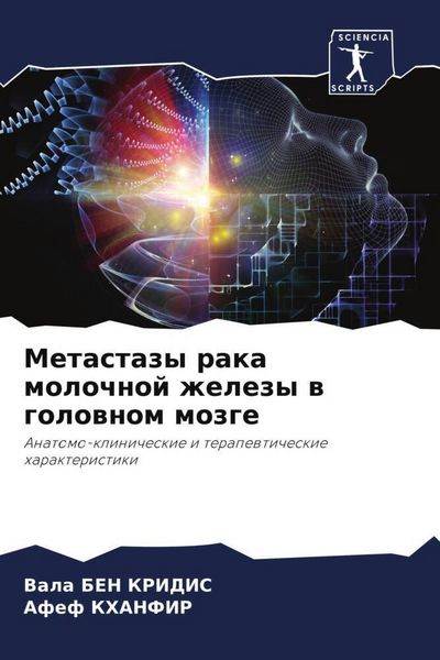 Produktbild: Metastazy raka molochnoj zhelezy w golownom mozge
