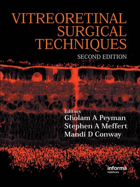 Produktbild: Vitreoretinal Surgical Techniques, Second Edition
