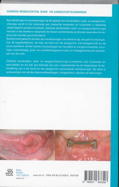 Produktbild: Zakboek mondziekten, kaak- en aangezichtschirurgie