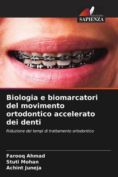 Produktbild: Biologia e biomarcatori del movimento ortodontico accelerato dei denti