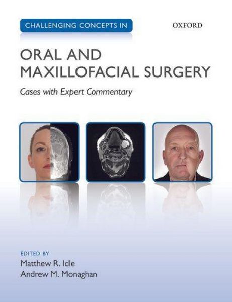 Produktbild: Challenging Concepts in Oral and Maxillofacial Surgery
