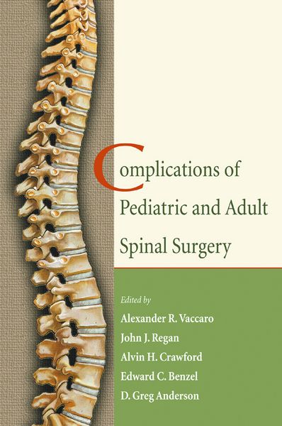Produktbild: Complications of Pediatric and Adult Spinal Surgery