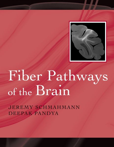 Produktbild: Fiber Pathways of the Brain