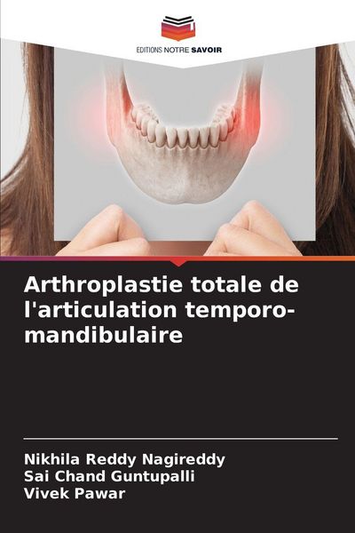 Produktbild: Arthroplastie totale de l'articulation temporo-mandibulaire