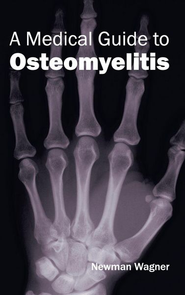 Produktbild: A Medical Guide to Osteomyelitis
