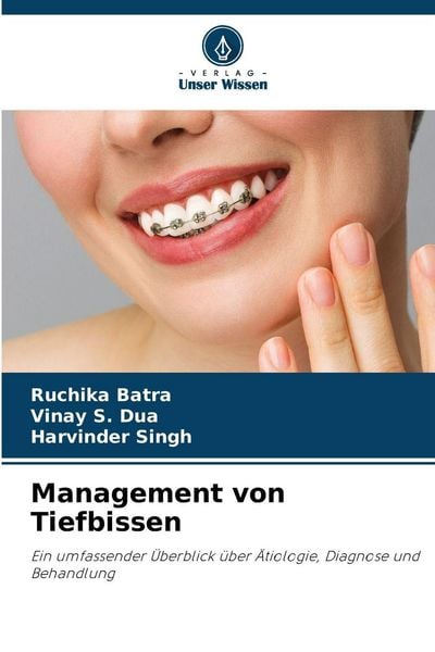Management von Tiefbissen, Taschenbuch von Ruchika Batra , Vinay S. Dua , Harvinder Singh, Verlag Unser Wissen, 9786209089220