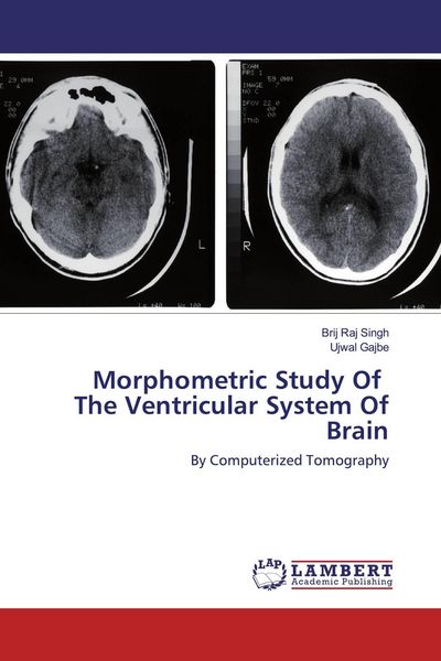 Produktbild: Morphometric Study Of The Ventricular System Of Brain