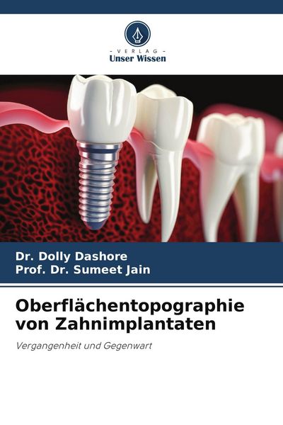 Produktbild: Oberfl&auml;chentopographie von Zahnimplantaten