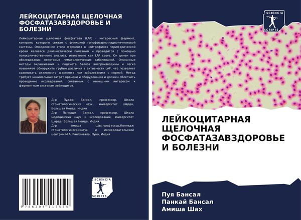 Produktbild: LEJKOCITARNAYa ShhELOChNAYa FOSFATAZAVZDOROV'E I BOLEZNI