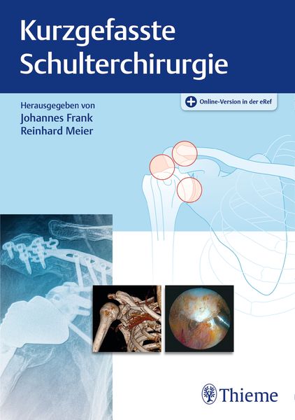 Produktbild: Kurzgefasste Schulterchirurgie