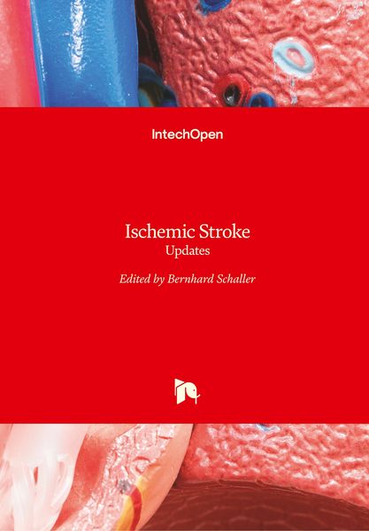 Produktbild: Ischemic Stroke