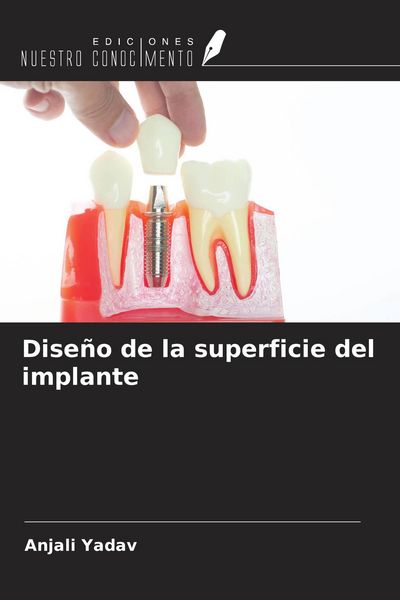 Produktbild: Dise&ntilde;o de la superficie del implante